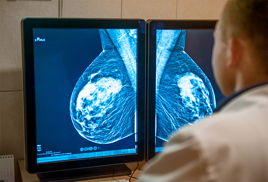San_Lorenzino_Cesena_Servizi_Diagnostica_per_Immagini_Mammografia_